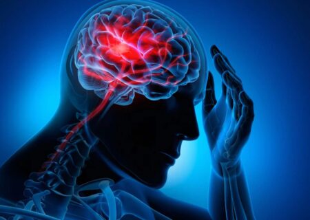 انتشار نتایج درمان حاد سکته مغزی توسط دانشمندان چینی