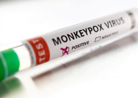 ابداع روش‌های آزمایش سریع جهت تشخیص ویروس آبله میمون